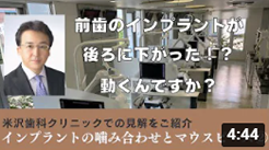 インプラントの噛み合わせとマウスピース②