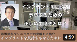 インプラントを長持ちさせるために