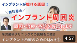 インプラント治療のためのQ&A③