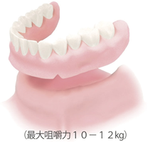 総入れ歯