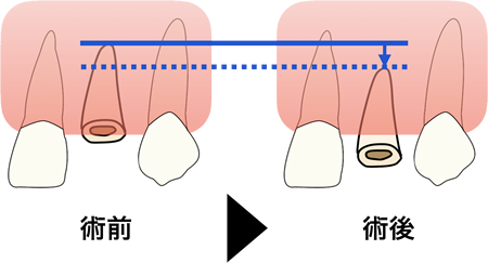 術前・術後