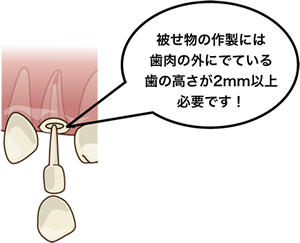 術前・術後