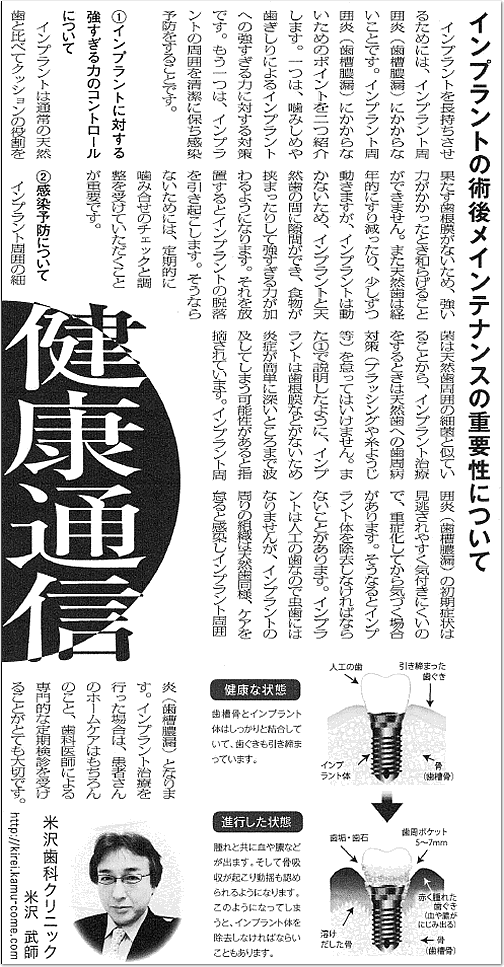 インプラントの術後メインテナンスの重要性について