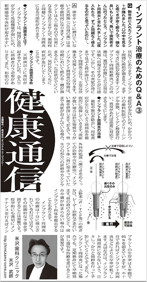 インプラント治療のためのQ＆A③