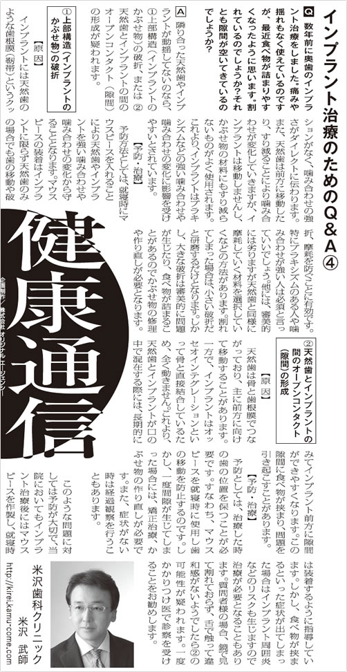 インプラント治療のためのQ＆A④