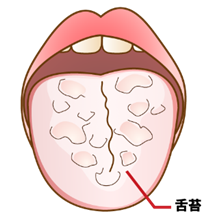 舌苔