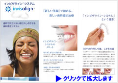 Invisalign