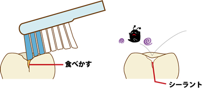 シーラント