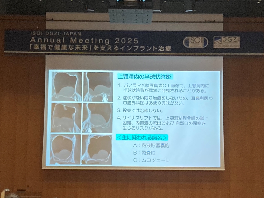 ICOI国際口腔インプラント学会 日本支部学術大会
